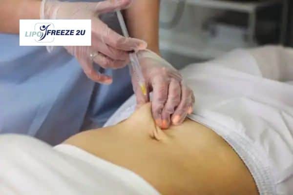 Fat Dissolving Injections Billericay & Weight loss medication