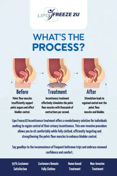 Diagram of how incontinence treatment Billericay works.