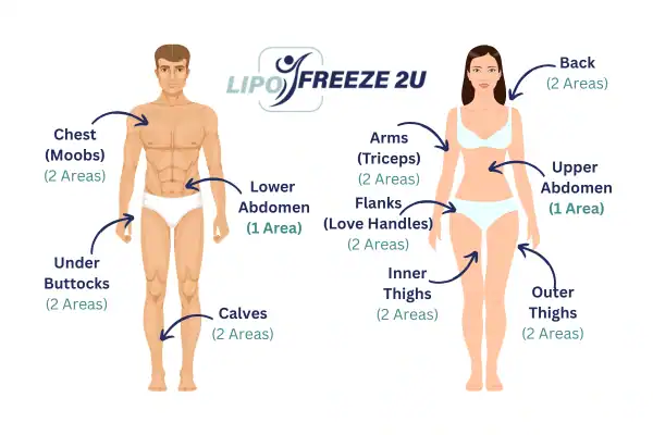 Areas you can have fat freezing treatment Billericay